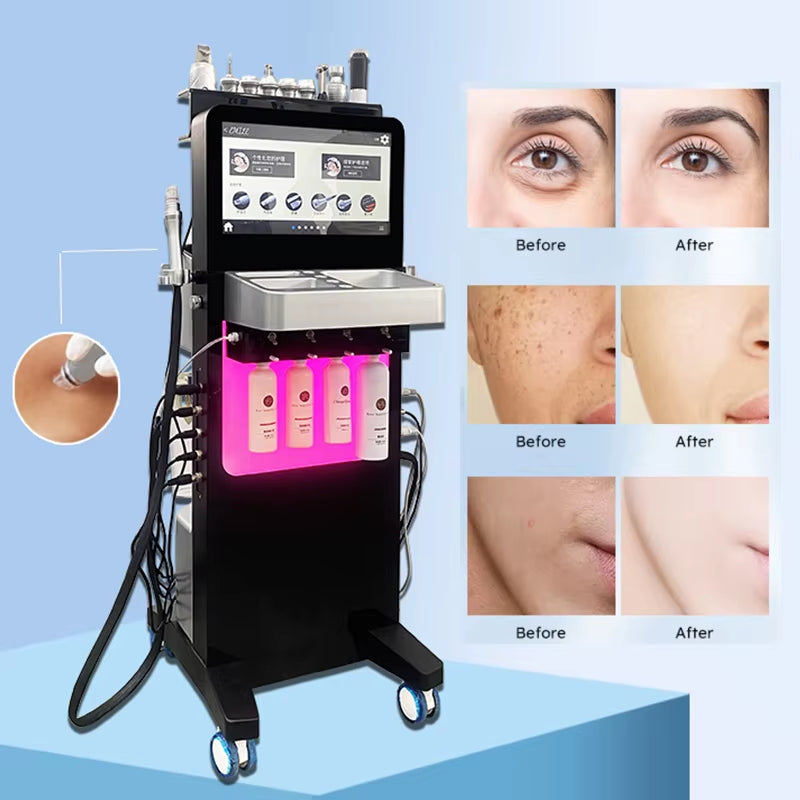 Skin Care Machine 12-In-1 Skin Rejuvenation Device Beauty Salon Spa Skin Care Equipment