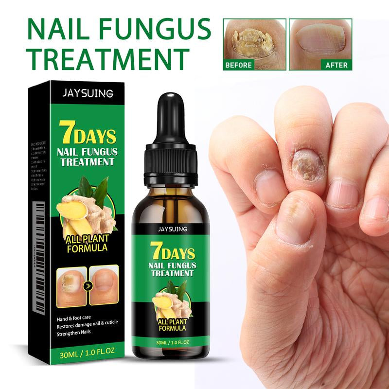 Ginger Nail Treatment Multi-Functional Nail Repair Nail Support Nail Care Natural Nail Care Comfort Nail Polish