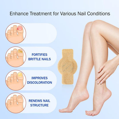 Fungal Nail Patches, Nail Care Patches, Professional Nail Care Product Suitable for Solving Fungal Nails and Other Nail Problems