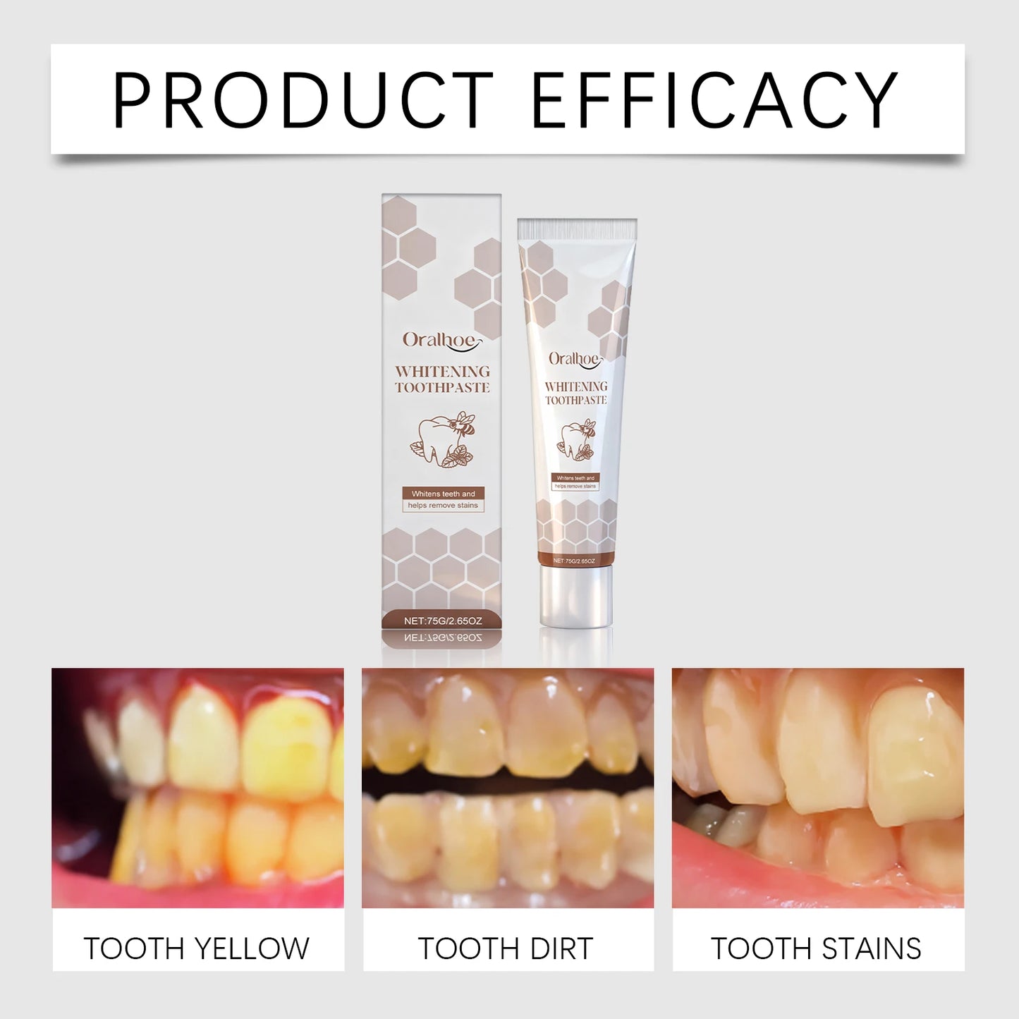 ORALHOE Gum Care Toothpaste Refreshing Breath Enamel Reinforcement Brightens Teeth Rich Foam Comfortable Brushing