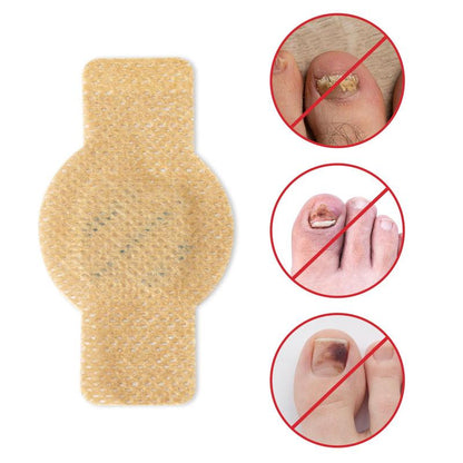 Fungal Nail Patches, Nail Care Patches, Professional Nail Care Product Suitable for Solving Fungal Nails and Other Nail Problems