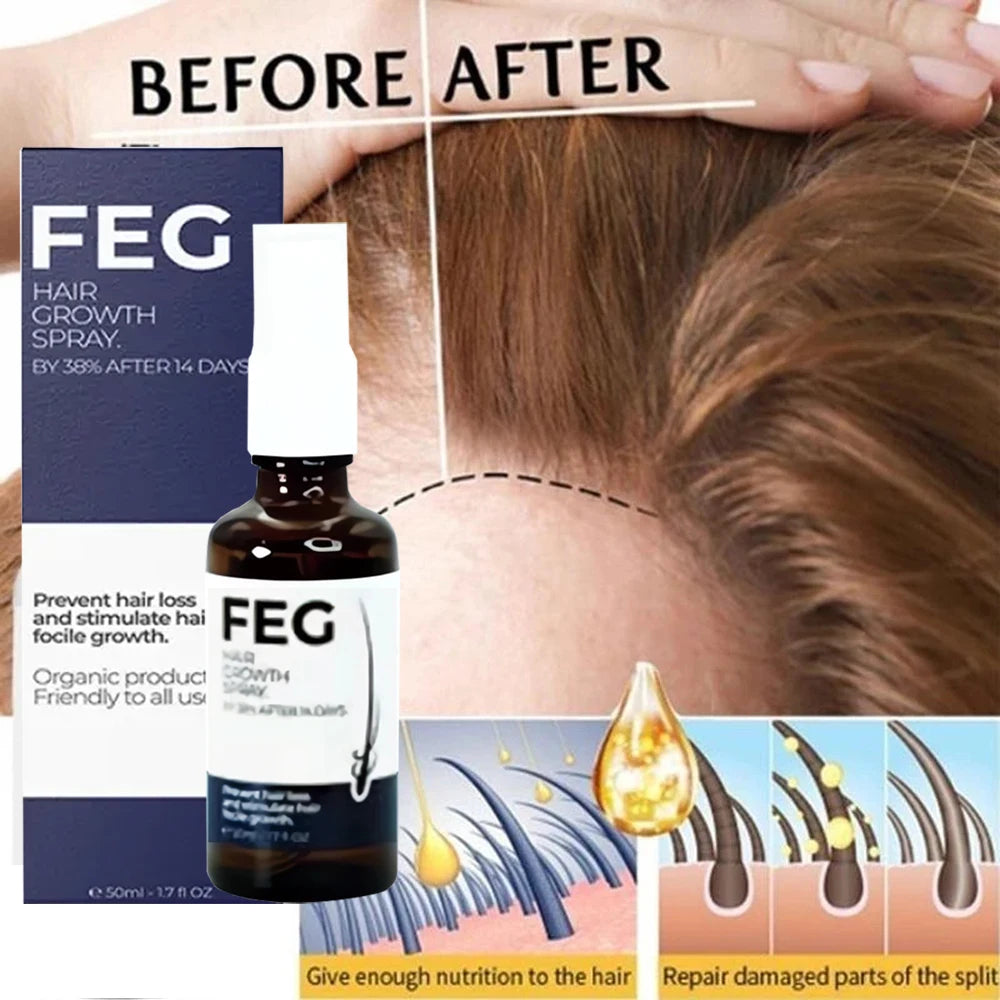 Best Hair Care Product FEG Hair Care Spray Serum for Hair Loss 50Ml